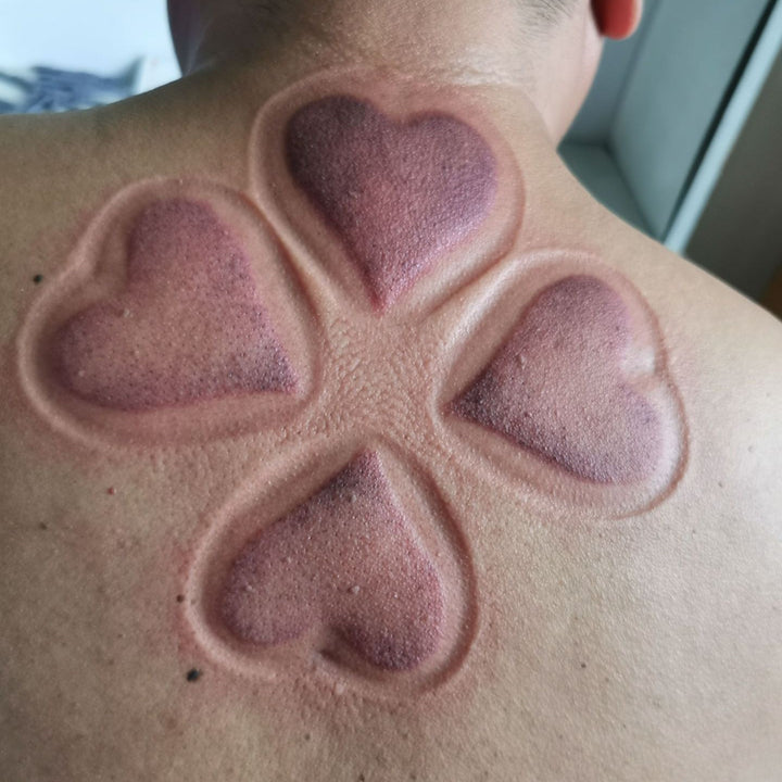 Special Shape Cupping Set-AML10195