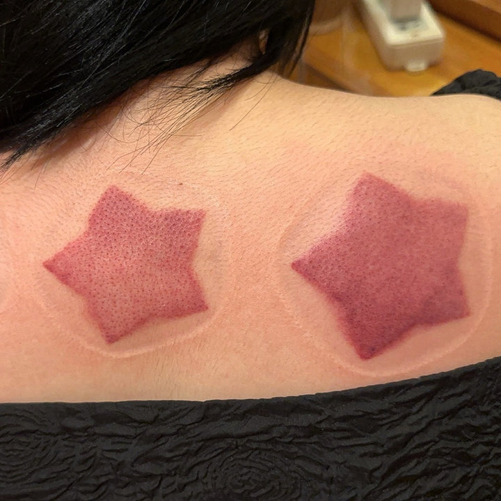 Special Shape Cupping Set-AML10195