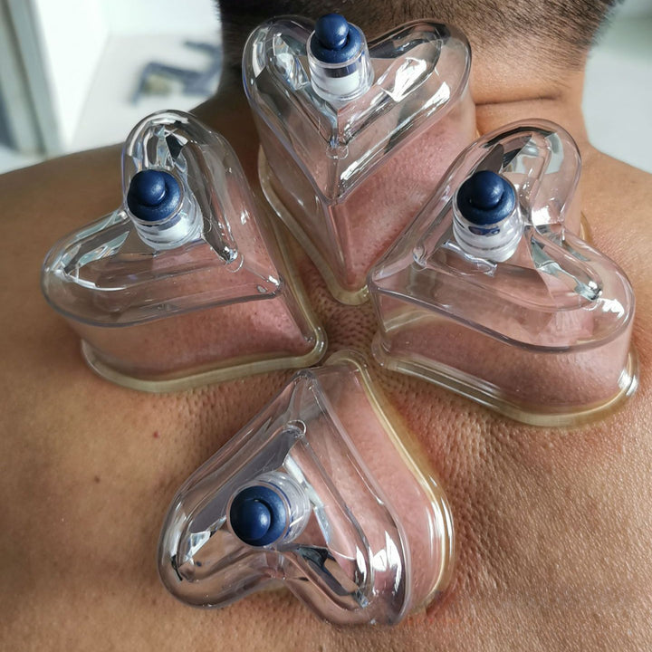 Special Shape Cupping Set-AML10195