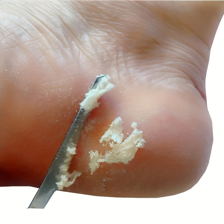 Professional Metal Foot File for Callus and Dead Skin Removal HeavyDuty Pedicure Tool for Smooth Heels Unscented DoubleSided Foot Scraper for Home Use